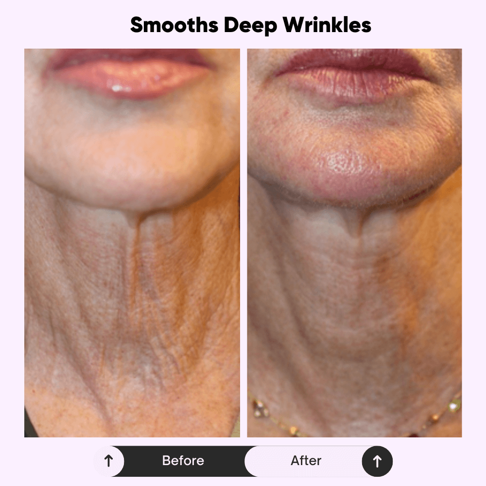 Celivè™ Tighten & Lift Neck Cream