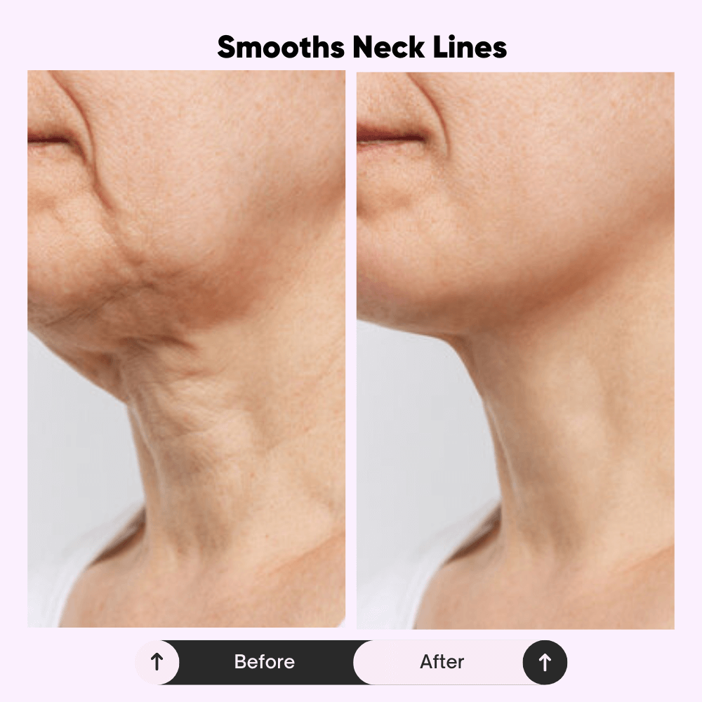 Celivè™ Tighten & Lift Neck Cream