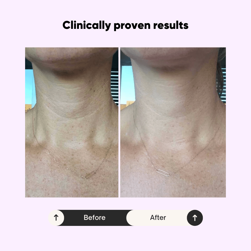 Celivè™ Tighten & Lift Neck Cream