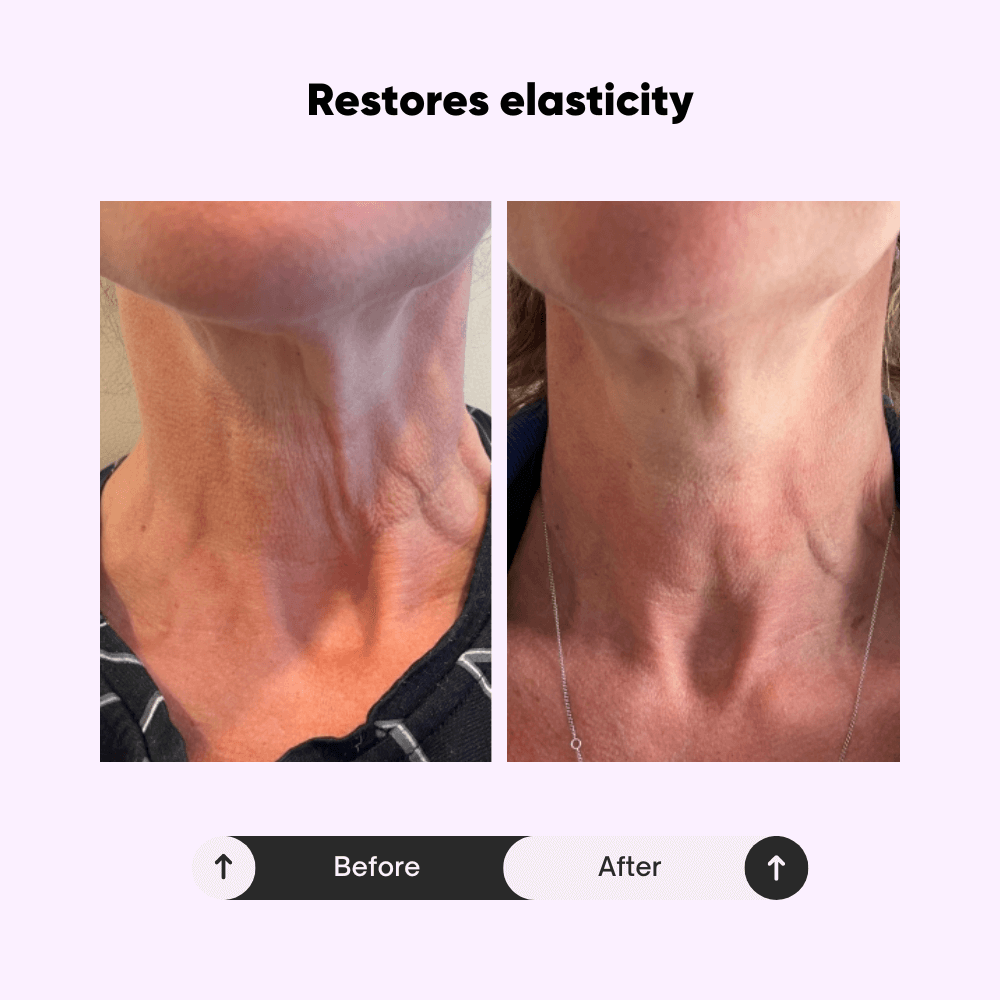 Celivè™ Tighten & Lift Neck Cream