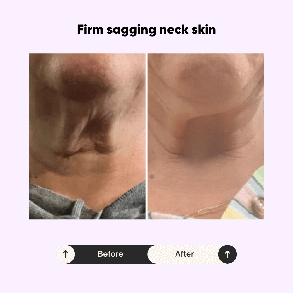 Celivè™ Tighten & Lift Neck Cream
